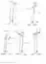 Fig. 14 -  DEVICE FOR INSUFFLATING THE INTERIOR OF A GASTRIC CAVITY OF A PATIENT
