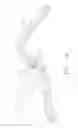 Fig. 16 -  DEVICE FOR INSUFFLATING THE INTERIOR OF A GASTRIC CAVITY OF A PATIENT