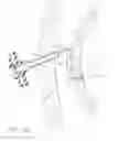Fig. 20 -  DEVICE FOR INSUFFLATING THE INTERIOR OF A GASTRIC CAVITY OF A PATIENT