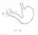 Fig. 41 -  DEVICE FOR INSUFFLATING THE INTERIOR OF A GASTRIC CAVITY OF A PATIENT