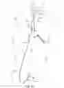 Fig. 03 - Methods and systems for establishing retrograde carotid arterial blood flow