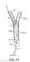 Fig. 06 - Methods and systems for establishing retrograde carotid arterial blood flow