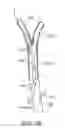 Fig. 07 - Methods and systems for establishing retrograde carotid arterial blood flow