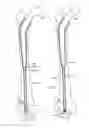 Fig. 28 - Methods for utilizing vibratory energy to weld, stake and/or remove implants