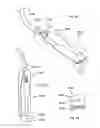 Fig. 44 - Methods for utilizing vibratory energy to weld, stake and/or remove implants
