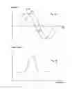Fig. 45 - Methods for utilizing vibratory energy to weld, stake and/or remove implants