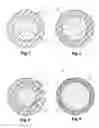 Fig. 02 - EDM wire