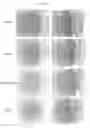 Fig. 09 - Emmprin antagonists and uses thereof