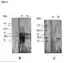 Fig. 03 - Ostertagia vaccine