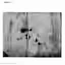 Fig. 09 - Ostertagia vaccine