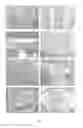 Fig. 07 - Use of Stem Cells, Method of Tissue Engineering, Use of Dental Tissues and Tooth Biological Substitute
