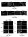Fig. 07 - Abnormalities of Phosphatase 2A (PP2A) for Diagnosis and Treatment of Alzheimer's Disease