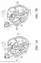 Fig. 03 - Lead assembly having a tethered sensor and methods related thereto