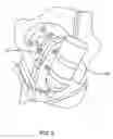 Fig. 03 - Nitrous-oxide system for an engine