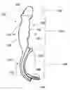 Fig. 01 - Airway intubation device