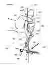 Fig. 06 - Airway intubation device