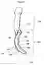 Fig. 08 - Airway intubation device