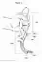 Fig. 12 - Airway intubation device