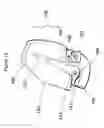 Fig. 14 - Airway intubation device