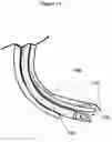 Fig. 15 - Airway intubation device
