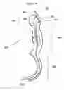 Fig. 17 - Airway intubation device
