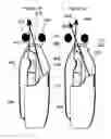 Fig. 19 - Airway intubation device