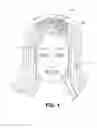 Fig. 02 - Hair volumizing device