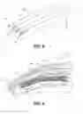Fig. 06 - Hair volumizing device
