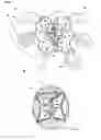 Fig. 02 - Controlled degradation of expandable polymers in gastric volume reduction treatment