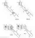 Fig. 06 - Cure through laminate veneer applicator