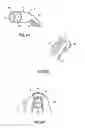 Fig. 08 - Cure through laminate veneer applicator