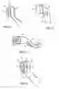 Fig. 09 - Cure through laminate veneer applicator