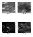 Fig. 08 - Hydroxyapatite coated nanostructured titanium surfaces