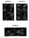 Fig. 07 - NPC1L1 AND NPC1L1 INHIBITORS AND METHODS OF USE THEREOF