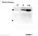 Fig. 06 - Hypoxia-regulated genes