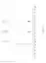Fig. 05 - Method of preparing naphthalocyanines