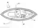 Fig. 01 - Apparatus and method of enhancing sexual satisfaction via an implantable vibrating device