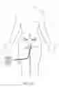 Fig. 08 - Optical scanning module and means for attaching the module to medical instruments for introducing the module into the anatomy
