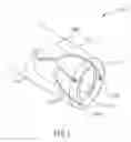 Fig. 02 - Endoscopic sheath with illumination