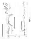 Fig. 22 - Method and system for diagnosis of lower urinary tract dysregulation and related conditions