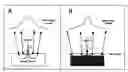 Fig. 01 - Method and apparatus for determination of atherosclerotic plaque type by measurement of tissue optical properties