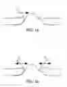 Fig. 02 - SUBSTANCE SAMPLING AND/OR SUBSTANCE DELIVERY VIA SKIN