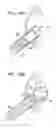 Fig. 22 - Injectable intraocular implants
