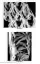 Fig. 04 - Bioresorbable implant