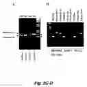 Fig. 04 - CAP/SORBS1 AND DIABETES
