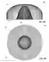 Fig. 09 - Free-form lenses for rectangular illumination zones
