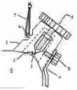 Fig. 01 - Camera accessory mount using shoulder strap loop