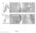 Fig. 02 - Method of treating dermatological disorders