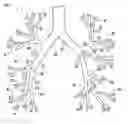 Fig. 01 - MONOPOLAR ENERGY DELIVERY DEVICES AND METHODS FOR CONTROLLING CURRENT DENSITY IN TISSUE