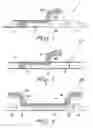 Fig. 02 - Nontraumatic Two-Point Needle for Surgical Suture